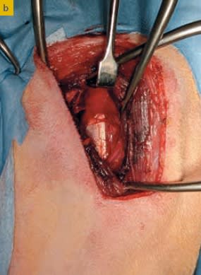 Ortopedia en pequeños animales. El miembro anterior3