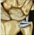 Sonin, Diagnostico por Imagen Musculoesqueletico 1: Enfermedades traumaticas2