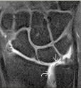 Sonin, Diagnostico por Imagen Musculoesqueletico 1: Enfermedades traumaticas3