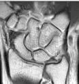 Sonin, Diagnostico por Imagen Musculoesqueletico 1: Enfermedades traumaticas4