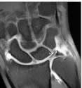 Sonin, Diagnostico por Imagen Musculoesqueletico 1: Enfermedades traumaticas5