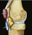Sonin, Diagnostico por Imagen Musculoesqueletico 1: Enfermedades traumaticas6