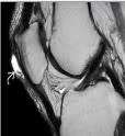 Sonin, Diagnostico por Imagen Musculoesqueletico 1: Enfermedades traumaticas7