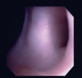 Complicaciones en Cirugía Urológica. Prevención y Manejo 2 Tomos Taneja, S.3