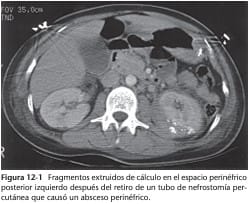Complicaciones en Cirugía Urológica. Prevención y Manejo 2 Tomos Taneja, S.4