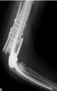 Tome Fracturas en el Anciano - Handbook2