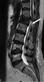 Tome Fracturas en el Anciano - Handbook1