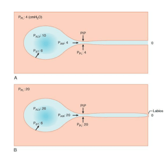 Miller Anestesia 2 Vol. 10 Ed1