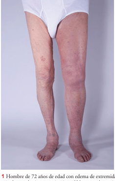 UPCHURCH ESCENARIOS CLINICOS EN CIRUGIA VASCULAR 2 ED7