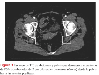 UPCHURCH ESCENARIOS CLINICOS EN CIRUGIA VASCULAR 2 ED6