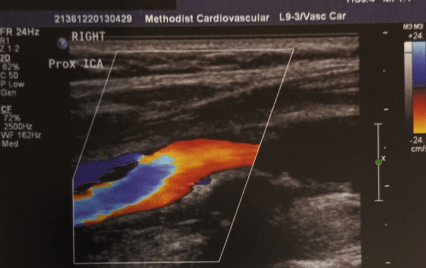 UPCHURCH ESCENARIOS CLINICOS EN CIRUGIA VASCULAR 2 ED4