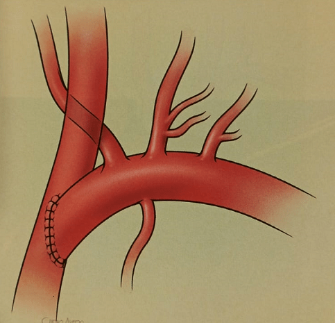 UPCHURCH ESCENARIOS CLINICOS EN CIRUGIA VASCULAR 2 ED3