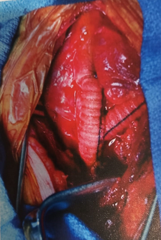 UPCHURCH ESCENARIOS CLINICOS EN CIRUGIA VASCULAR 2 ED1