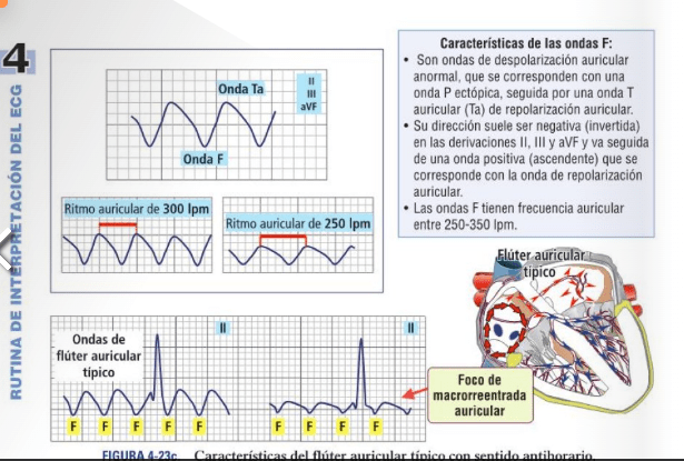 Velez ECG Handbook 4ª ed2