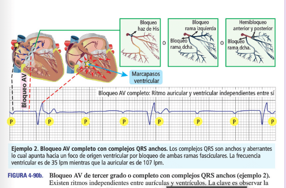 Velez ECG Handbook 4ª ed3