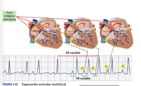 Velez ECG Handbook 4ª ed5