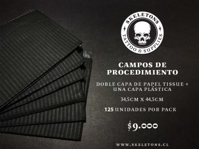 Campos de procedimiento Campos de procedimiento