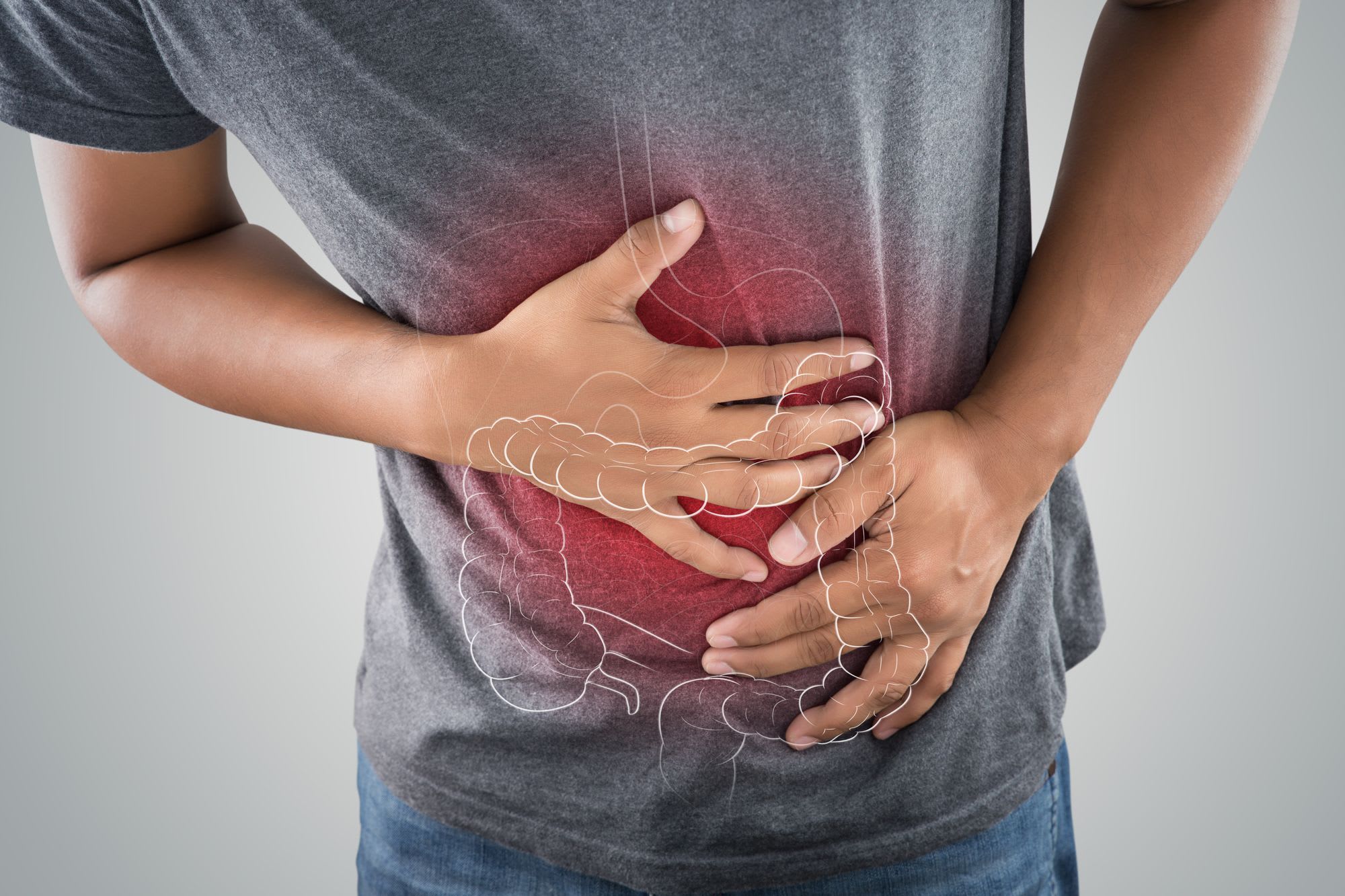 cuida tu colon cuida tu colon