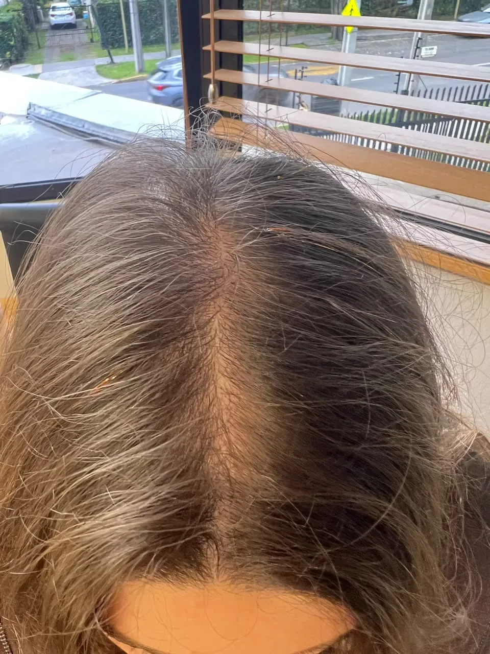 Después del seguimiento, vista superior frontal