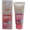 CREMA ANTI ESTRIAS1