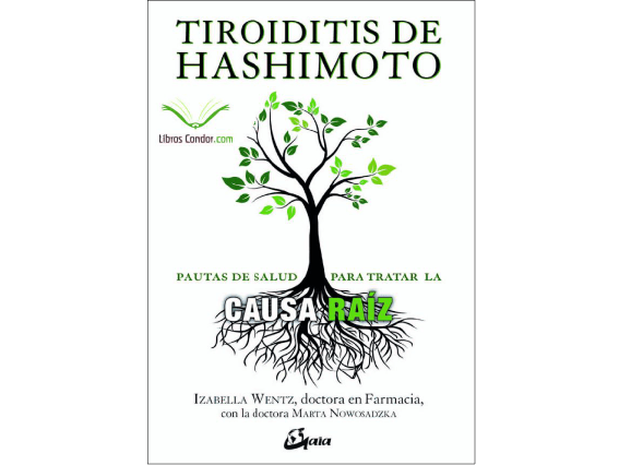 TIROIDITIS de HASHIMOTO1