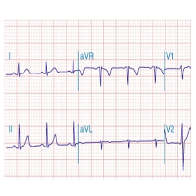 PAPEL ELECTRO ZIG-ZAG 90 X 701