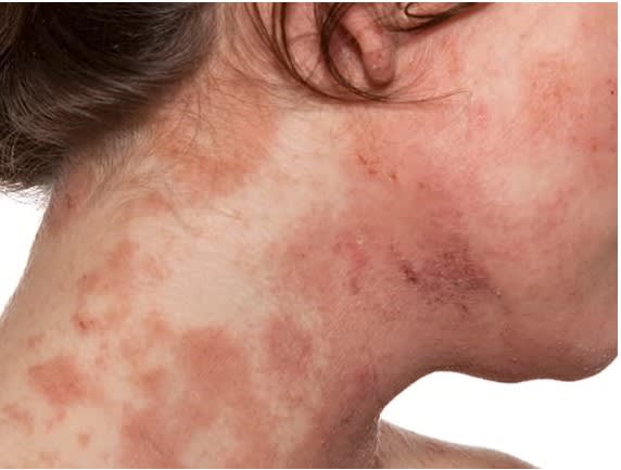 ABZOLEM REGENERADOR DE PIEL 30ML  - GHC3