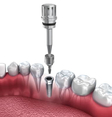 Cicatrizador MagDent MED