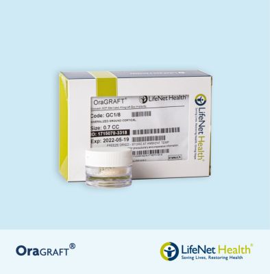 OraGRAFT®  ESPONJOSO MINERALIZADO