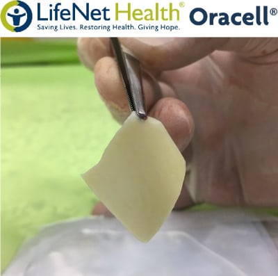 OrACELL Matriz Dérmica Acelular 1.26 - 1.75MM