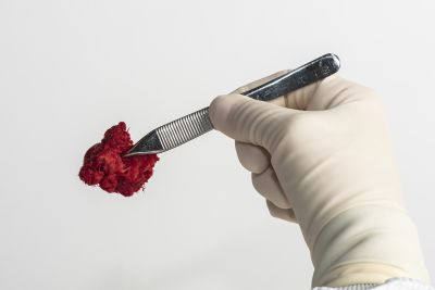 OraGRAFT® PRIME FIBRAS DESMINERALIZADAS