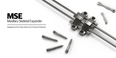 Estrategias Efectivas con Separadores MSE en Odontología Maxilofacial y Ortodoncia