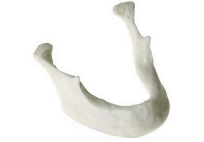 Teaching Mandible For Implants