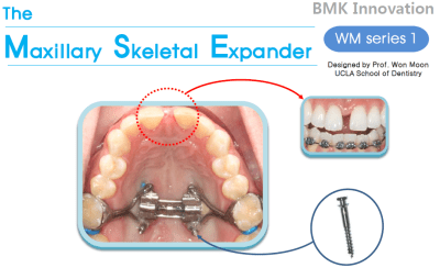 Kit MSEII-8 mm Inicial