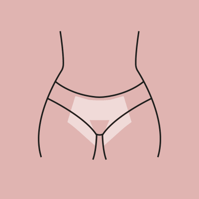 DEPILACIÓN LÁSER BIKINI INGLE