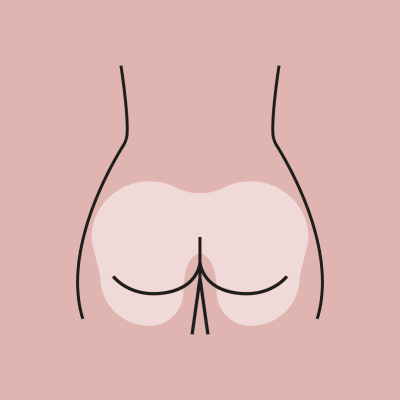 DEPILACIÓN LÁSER GLUTEOS