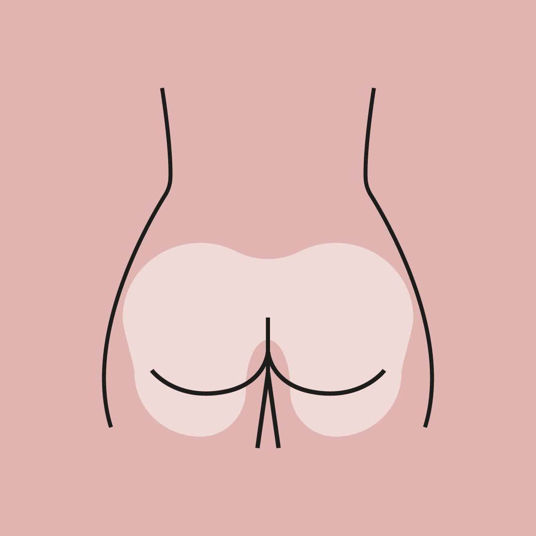 Vello Corporal Se Debe Depilar El Ano DEPILACIÓN ZONA PERIANAL