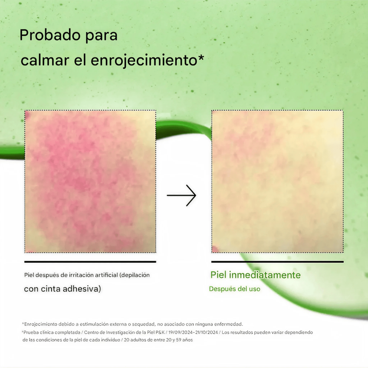 Anua 10+ Azelaic Acid 10 + Hyaluron Serum 30ml3