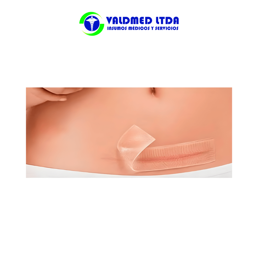 RYSTORA Rollo silicona cicatrices 25mmx1.5mts2