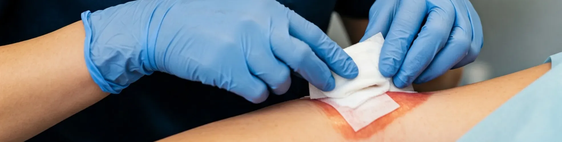 CUIDADO DE HERIDAS