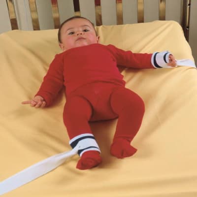 CONTENCION DE MANO NEONATO1