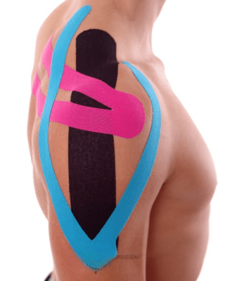 TAPE KINESIOLOGICO 5CM X 5 METROS