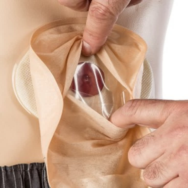 BOLSA COLOSTOMIA CON PLACA 80 MM AURUM2