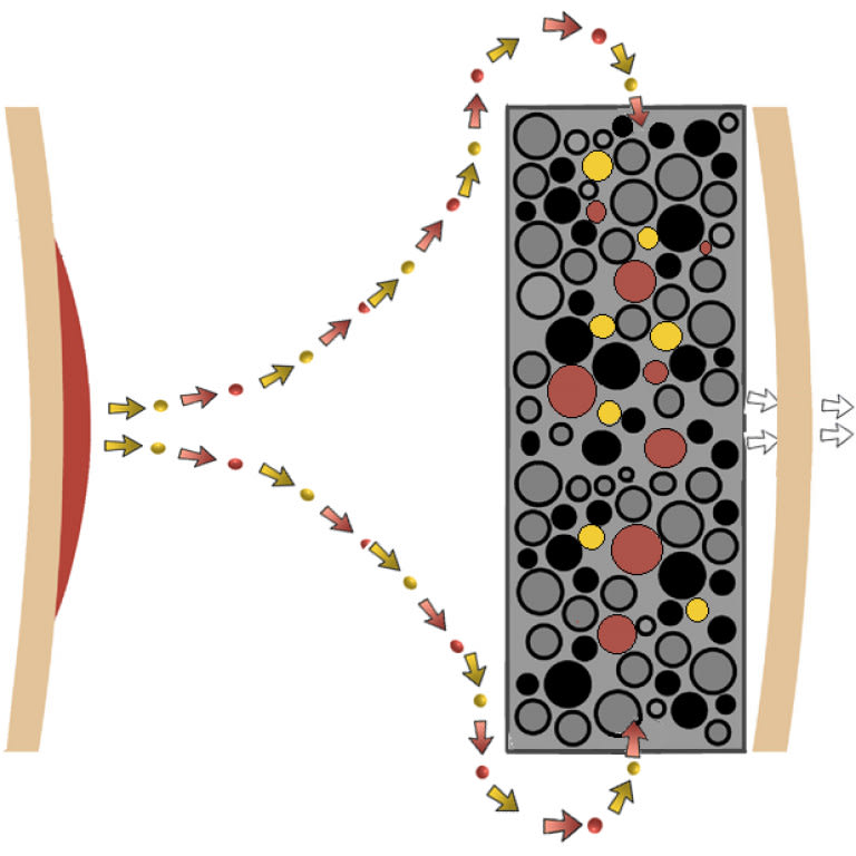 BOLSA COLOSTOMIA CON PLACA 80 MM AURUM3