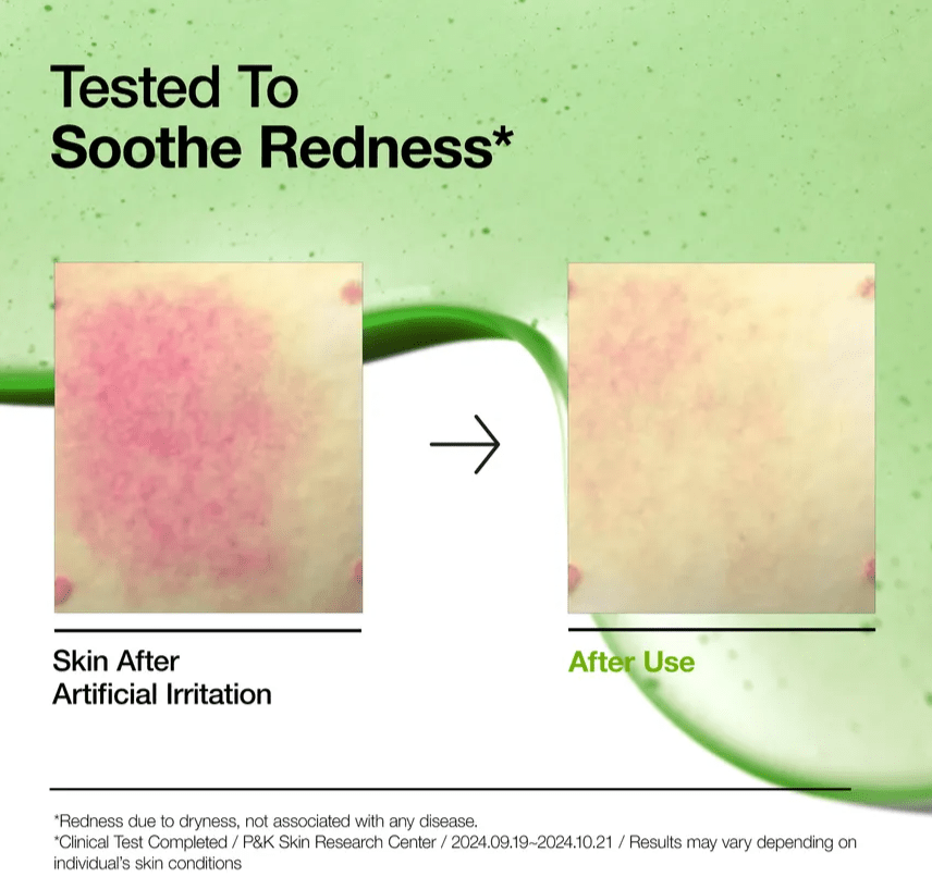 ANUA Azelaic Acid 10% Serum – Serum Anti-rojeces 30 ml3