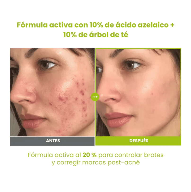 PURITO – Azelaic Acid 10 Kojic Tea Tree Serum – 30ml3