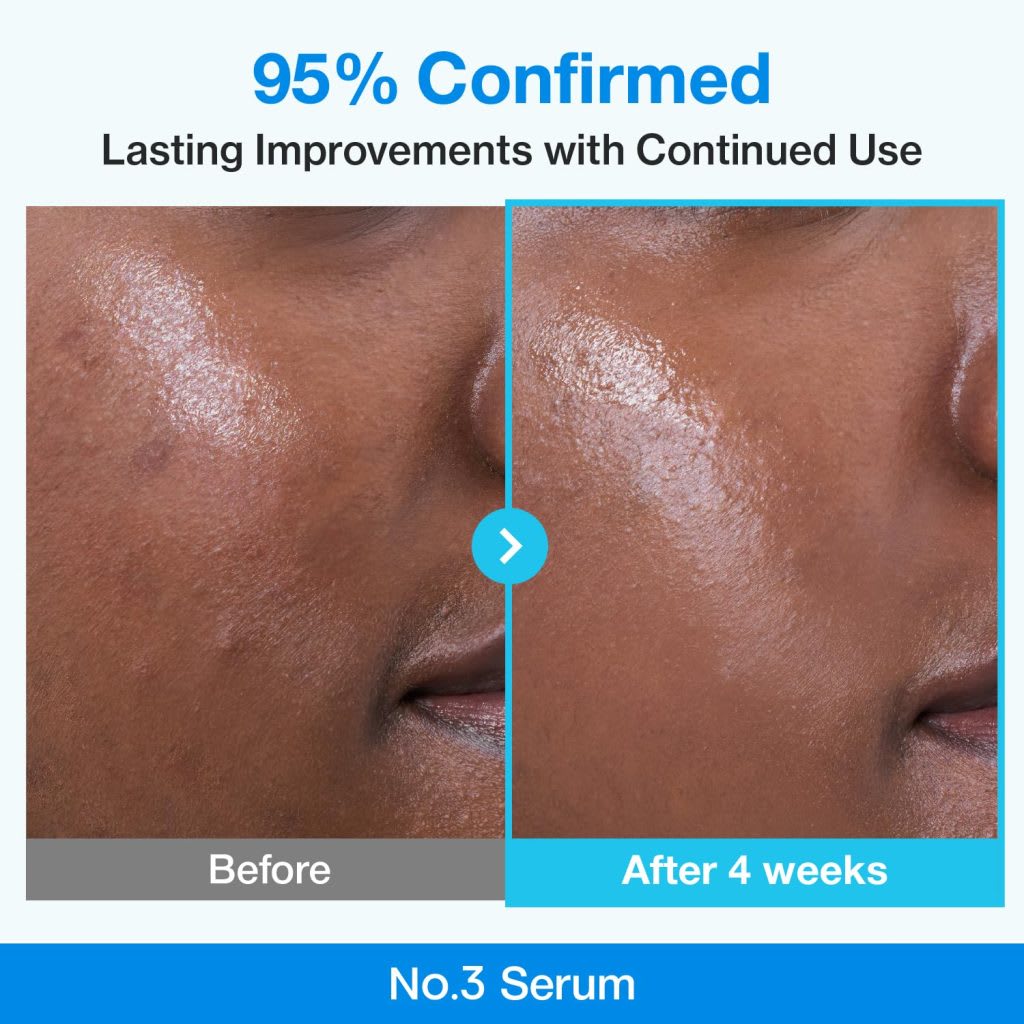 NUMBUZIN – Blue Bio-Retinol Pore Refining Serum – 10 piezas3